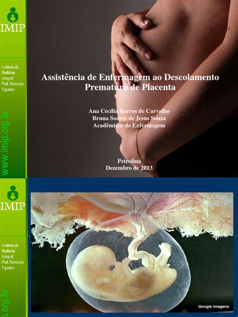 descolamento de placenta fotos-4